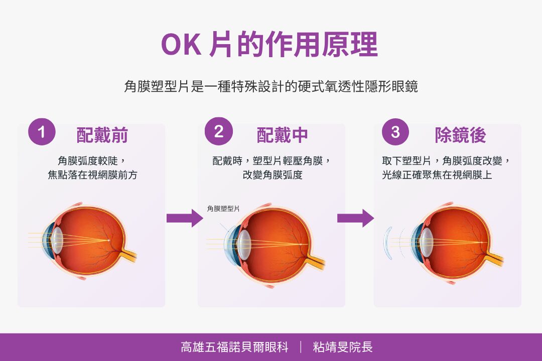 ok片的作用原理