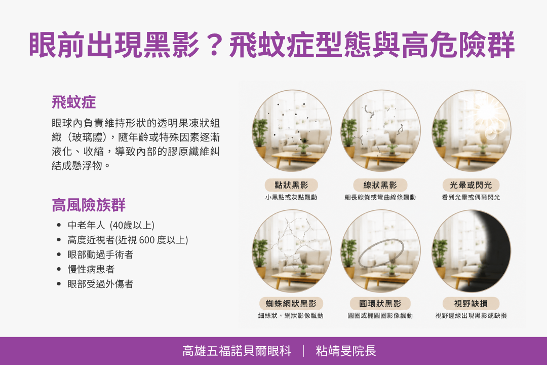 飛蚊症型態與高危險群